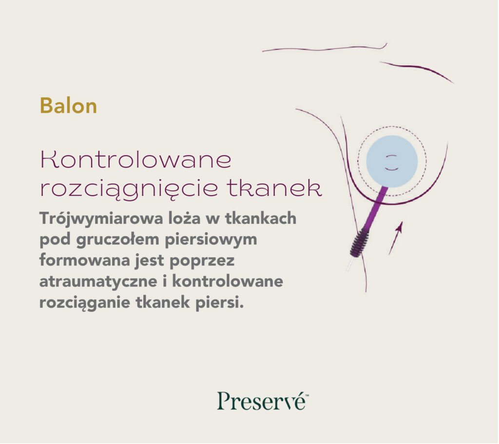 Preserve