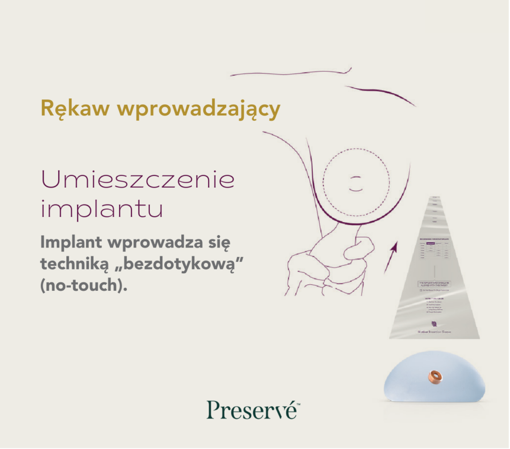 Preserve